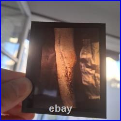 Rare Ensemble Blesses Guerre Operation Gueule Casse Medecin Poilu Ww1 Autochrome