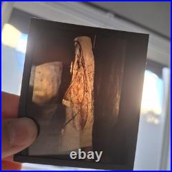 Rare Ensemble Blesses Guerre Operation Gueule Casse Medecin Poilu Ww1 Autochrome