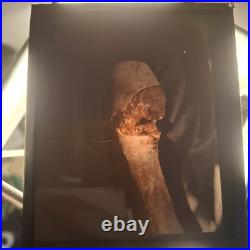 Rare Ensemble Blesses Guerre Operation Gueule Casse Medecin Poilu Ww1 Autochrome