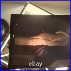 Rare Ensemble Blesses Guerre Operation Gueule Casse Medecin Poilu Ww1 Autochrome